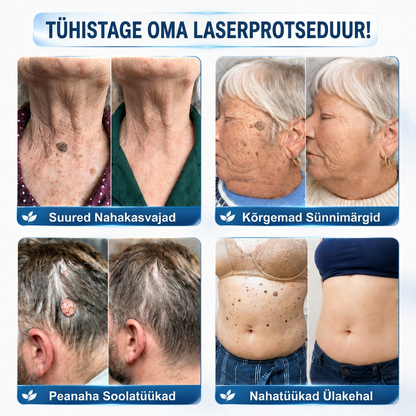 🇪🇪 Kvaliteetne Eesti toode, kiire riigisisene tarne | MURWON® 🌥️ Mikronõeltega plaastrid nahadefektide ilmingute vähendamiseks 🥦 (Nahapaksjendite, tüügaste, sünnimärkide, pigmendilaikude ja muude nähtavate nahadefektide korral.) 💪