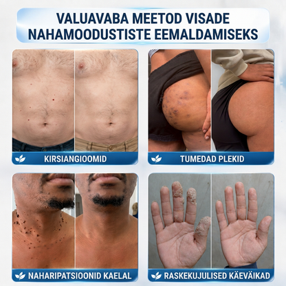 🇪🇪 Kvaliteetne Eesti toode, kiire riigisisene tarne | MURWON® 🌥️ Mikronõeltega plaastrid nahadefektide ilmingute vähendamiseks 🥦 (Nahapaksjendite, tüügaste, sünnimärkide, pigmendilaikude ja muude nähtavate nahadefektide korral.) 💪