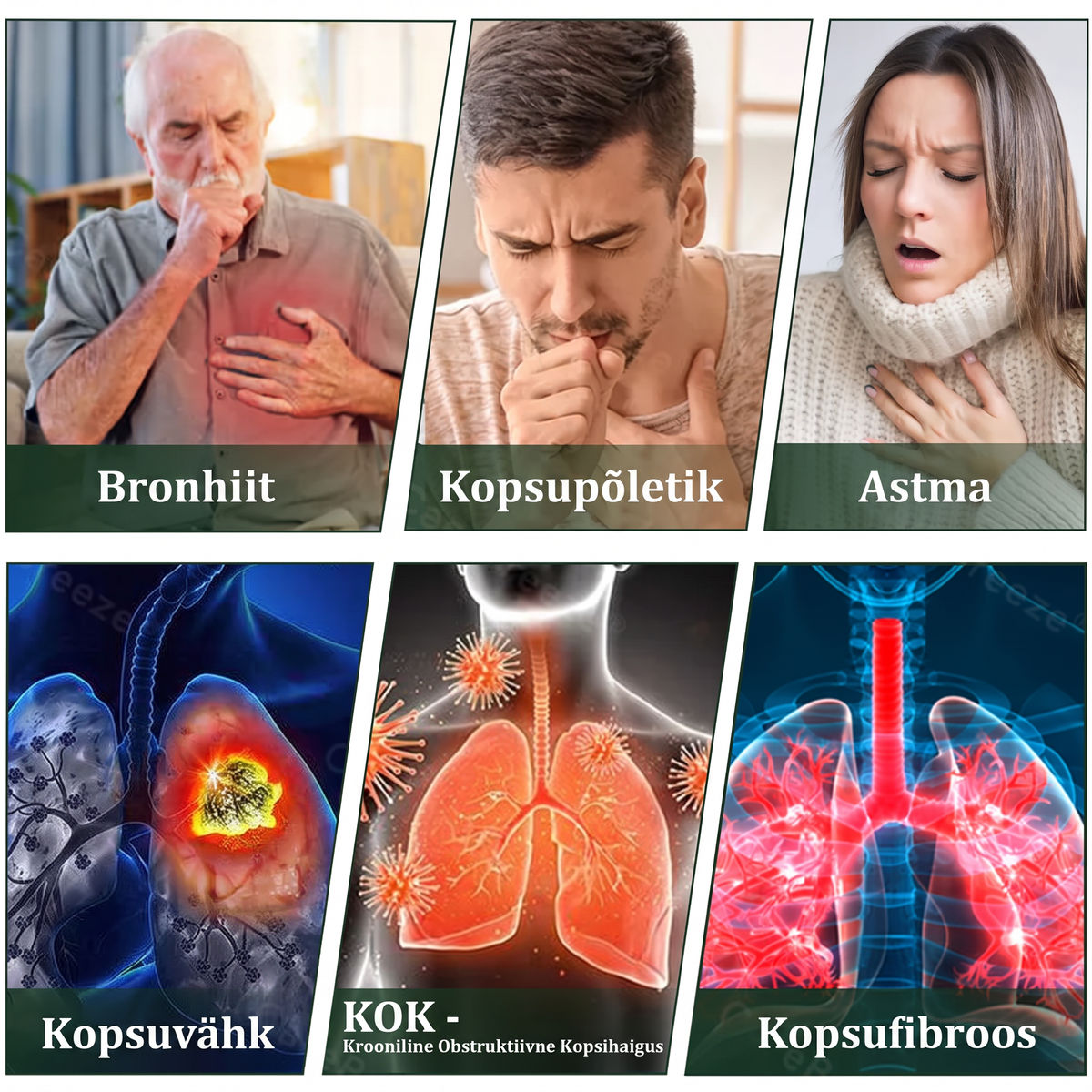 Tipptasemel eesti toode koduse kohaletoimetamisega 🥇 Murwon® taimne aurinhalaator kopsude puhastamiseks 🌽 Tõhus abi köha, kurgupõletiku, hingamisraskuste, lima, nohu, bronhiidi ja allergiate korral ❤️