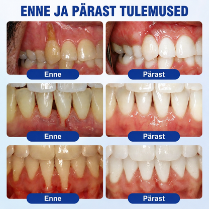 Hambaarstide soovitatud 👨‍⚕️🦷🛡️ Vitalisys® GumRevive – taastav igemegeel 🌥️❤️