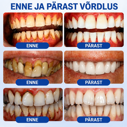 Hambaarstide soovitatud 👨‍⚕️🦷🛡️ Vitalisys® GumRevive – taastav igemegeel 🌥️❤️