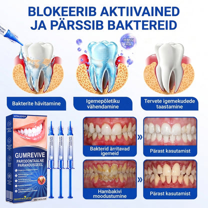Hambaarstide soovitatud 👨‍⚕️🦷🛡️ Vitalisys® GumRevive – taastav igemegeel 🌥️❤️